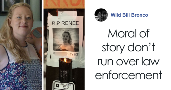 57 Fascinating And Unnerving Medical Photos Not Everyone Can Handle (New Pics)