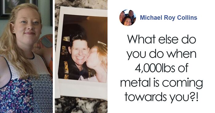 57 Fascinating And Unnerving Medical Photos Not Everyone Can Handle (New Pics)