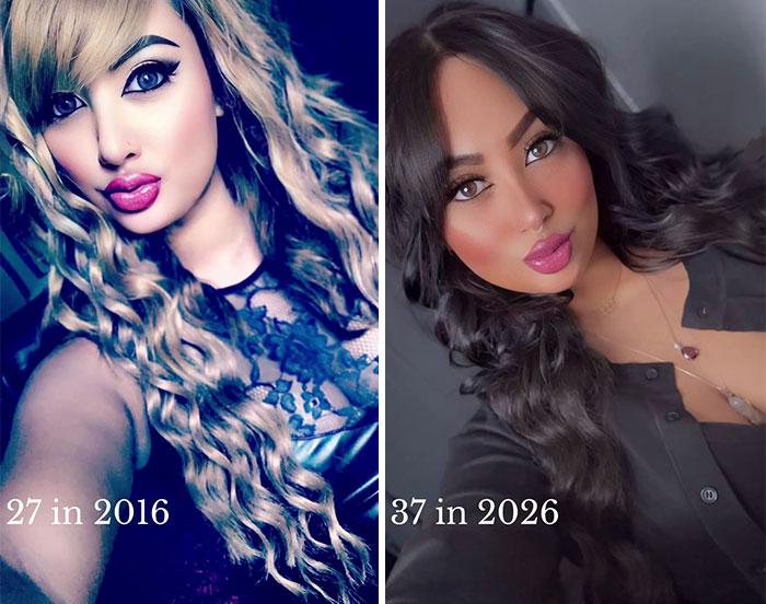 Side-by-side photos showing a woman at age 27 in 2016 and at age 37 in 2026, highlighting changes over time.