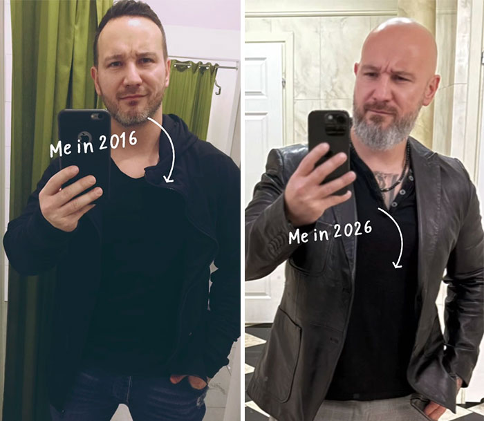 Side-by-side 2016 vs 2026 photos of a man showing changes in appearance over a decade from 65 people shared series.