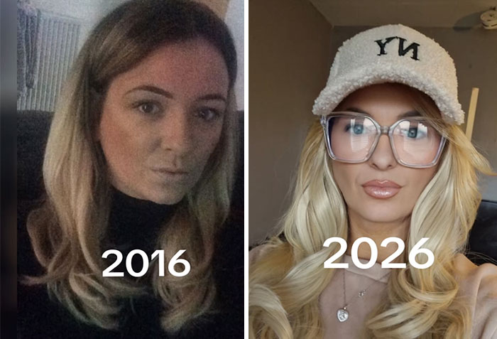 Side-by-side 2016 vs 2026 photos of a woman showing noticeable changes in appearance over the decade.