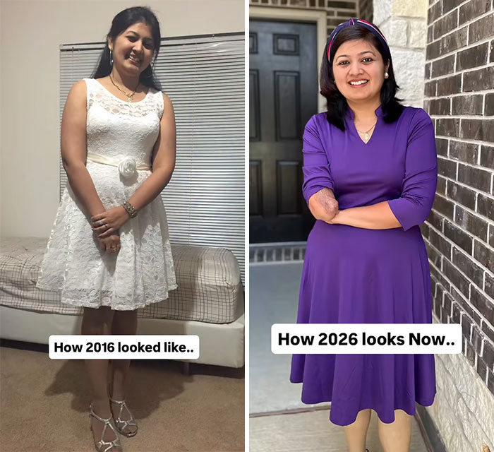 Side-by-side photos showing a woman’s transformation from 2016 to 2026 in a decade comparison photo.