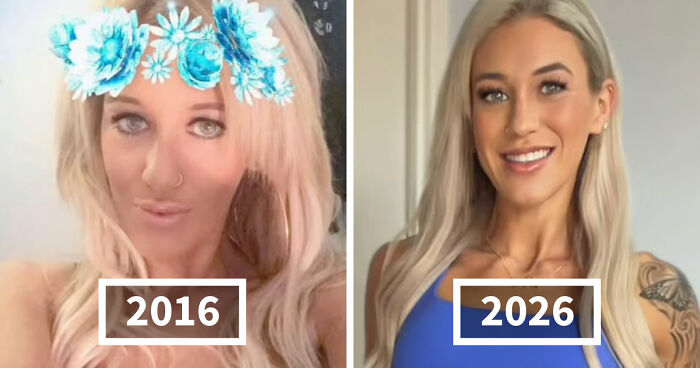 65 People Shared 2016 Vs. 2026 Photos, And Some Of Them Are Hard To Recognize