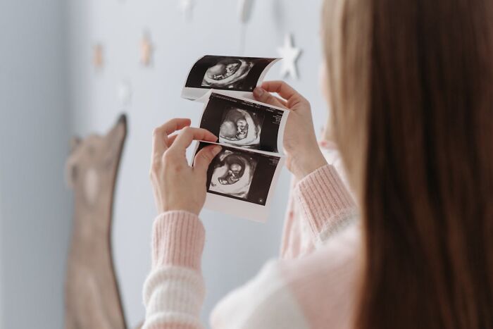 Woman in a pink and white sweater holding and examining ultrasound images, reflecting emotions linked to accidental texts.