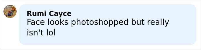 Comment on Amy Schumer trolling herself shortly after divorce filing amid backlash over bikini photos. Comment on Amy Schumer trolling herself shortly after divorce filing amid backlash over bikini photos.