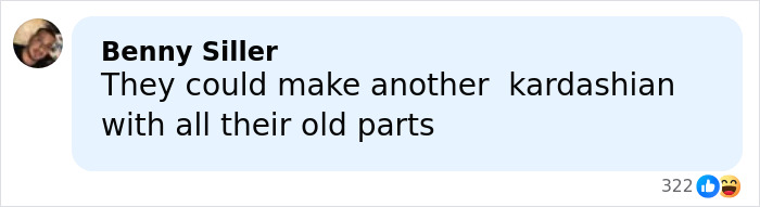 Internet Dragged Kendall Jenner After Her Claim That She’s Never Had Surgery Internet Dragged Kendall Jenner After Her Claim That She’s Never Had Surgery