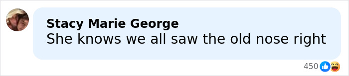 Internet Dragged Kendall Jenner After Her Claim That She’s Never Had Surgery Internet Dragged Kendall Jenner After Her Claim That She’s Never Had Surgery