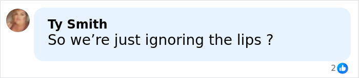 "Hand Her A Mirror": Kendall Jenner Draws Scrutiny After Denying Plastic Surgery Rumors