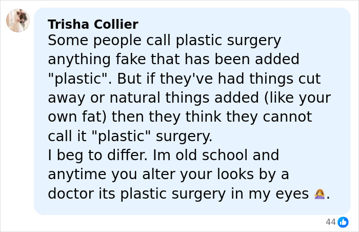 "Hand Her A Mirror": Kendall Jenner Draws Scrutiny After Denying Plastic Surgery Rumors