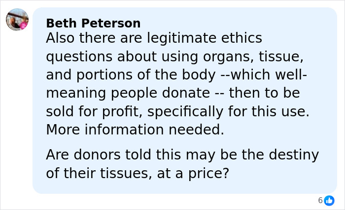 Comment discussing ethical concerns about using donated lifeless bodies for BBLs and breast implants in medical procedures. Comment discussing ethical concerns about using donated lifeless bodies for BBLs and breast implants in medical procedures.