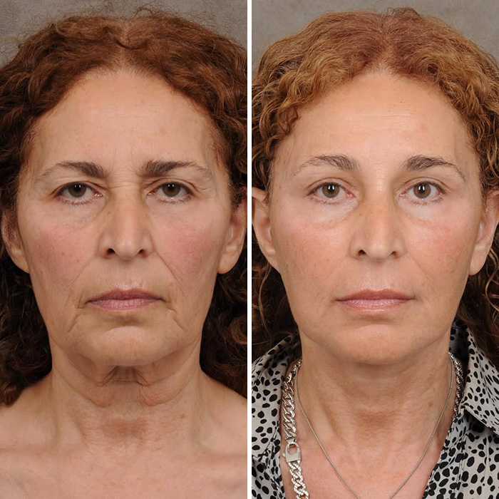 Plastic Surgeon Goes Viral After Dry Response To Facelift Critic Leaves Internet Laughing Hard Plastic Surgeon Goes Viral After Dry Response To Facelift Critic Leaves Internet Laughing Hard