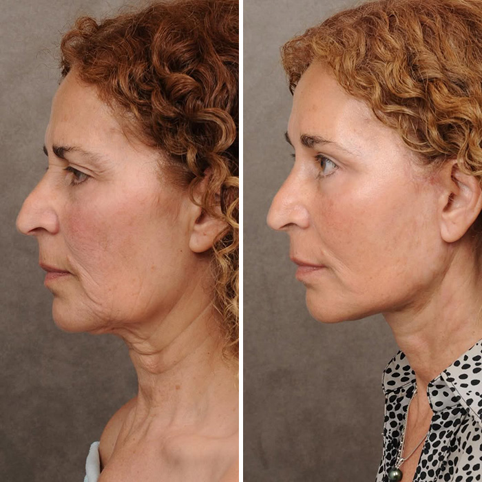 Plastic Surgeon Goes Viral After Dry Response To Facelift Critic Leaves Internet Laughing Hard Plastic Surgeon Goes Viral After Dry Response To Facelift Critic Leaves Internet Laughing Hard