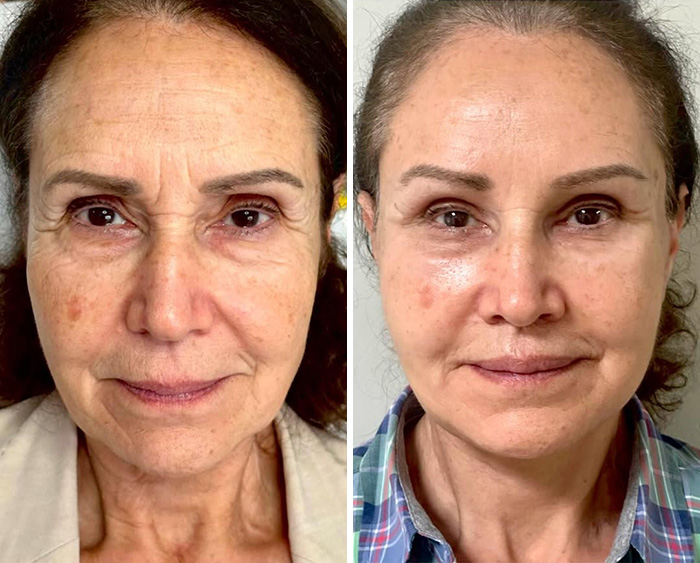 Plastic Surgeon Goes Viral After Dry Response To Facelift Critic Leaves Internet Laughing Hard Plastic Surgeon Goes Viral After Dry Response To Facelift Critic Leaves Internet Laughing Hard