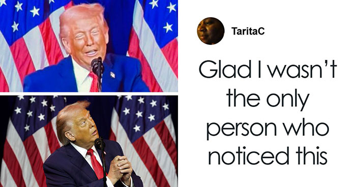 57 Fascinating And Unnerving Medical Photos Not Everyone Can Handle (New Pics)