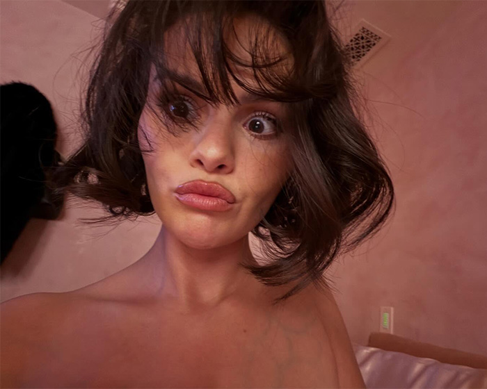 Selena Gomez with tousled hair making a surprised face, fans blaming plastic surgery for her transformation. Selena Gomez with tousled hair making a surprised face, fans blaming plastic surgery for her transformation.