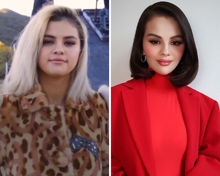 Side-by-side images of Selena Gomez showing a dramatic transformation fans blame on plastic surgery changes. Side-by-side images of Selena Gomez showing a dramatic transformation fans blame on plastic surgery changes.