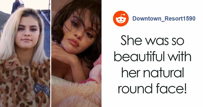Fans Blame Plastic Surgery For Selena Gomez’s “Unhinged” Transformation In Recent Snaps