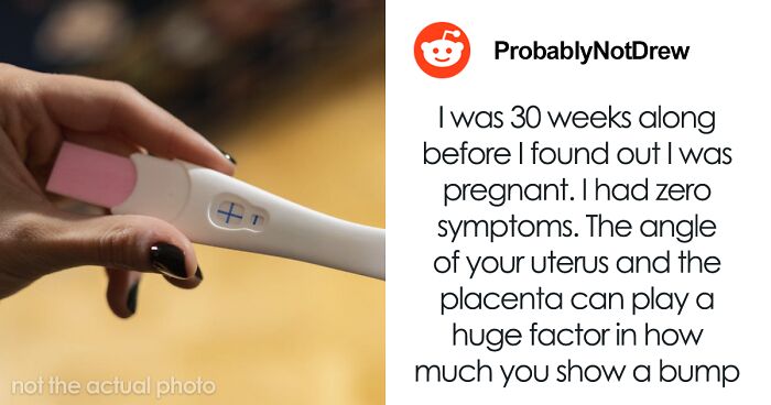 “It Rained Frogs”: 76 People Share True Events From Their Lives That Sound Completely Made Up