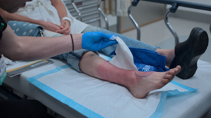 Healthcare worker wearing blue gloves cleaning a patient's reddened leg, highlighting MRSA hospital-acquired infection risks. Healthcare worker wearing blue gloves cleaning a patient's reddened leg, highlighting MRSA hospital-acquired infection risks.