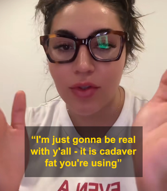 Close-up of a woman wearing glasses explaining the use of cadaver fat in BBLs and breast implants procedures. Close-up of a woman wearing glasses explaining the use of cadaver fat in BBLs and breast implants procedures.