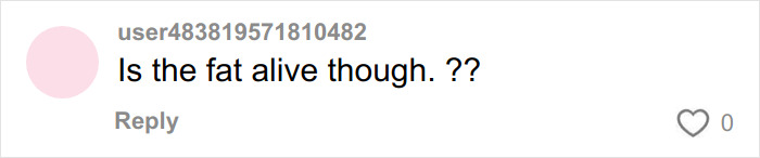 Comment on social media post questioning fat survival in surgical procedures related to donated lifeless bodies for BBLs and breast implants. Comment on social media post questioning fat survival in surgical procedures related to donated lifeless bodies for BBLs and breast implants.