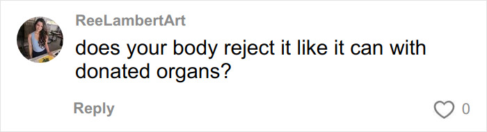 Comment asking if the body rejects donated organs like it might with lifeless bodies used for BBLs and breast implants. Comment asking if the body rejects donated organs like it might with lifeless bodies used for BBLs and breast implants.