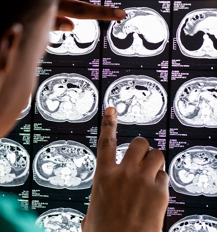 Doctor examining brain and abdominal scans on a lightbox highlighting heartbreaking medical conditions that can’t be cured.