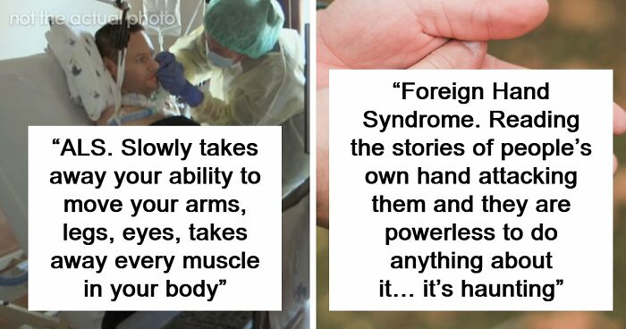“Can’t Be Cured”: 38 Absolutely Heartbreaking Medical Conditions That No Person Deserves To Have