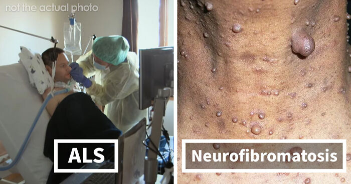“Can’t Be Cured”: 38 Absolutely Heartbreaking Medical Conditions That No Person Deserves To Have