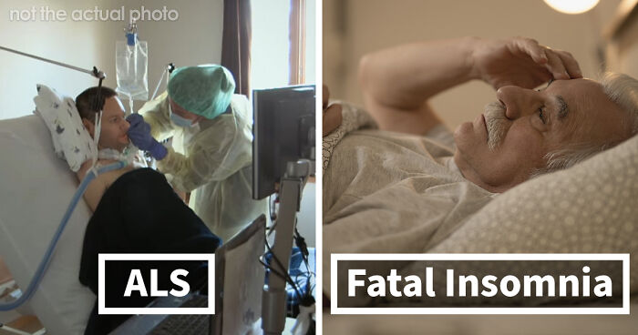“Can’t Be Cured”: 38 Absolutely Heartbreaking Medical Conditions That No Person Deserves To Have