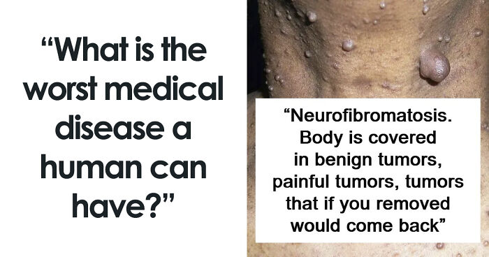 “Can’t Be Cured”: 38 Absolutely Heartbreaking Medical Conditions That No Person Deserves To Have