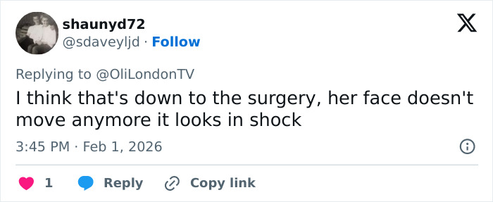 &ldquo;How Is This Possible?&rdquo;: Frenzy Over Botched Plastic Surgery And Weight Loss After The Grammys