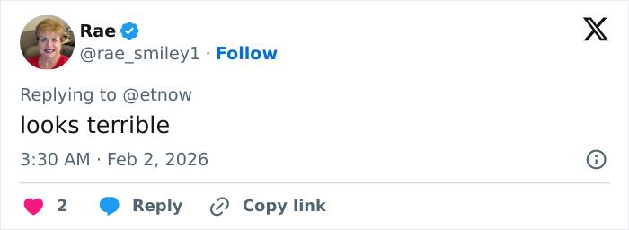 “How Is This Possible?”: Frenzy Over Botched Plastic Surgery And Weight Loss After The Grammys “How Is This Possible?”: Frenzy Over Botched Plastic Surgery And Weight Loss After The Grammys