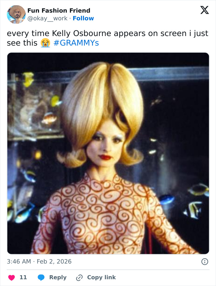 &ldquo;How Is This Possible?&rdquo;: Frenzy Over Botched Plastic Surgery And Weight Loss After The Grammys