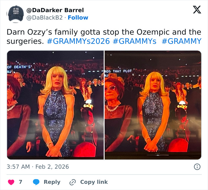 &ldquo;How Is This Possible?&rdquo;: Frenzy Over Botched Plastic Surgery And Weight Loss After The Grammys