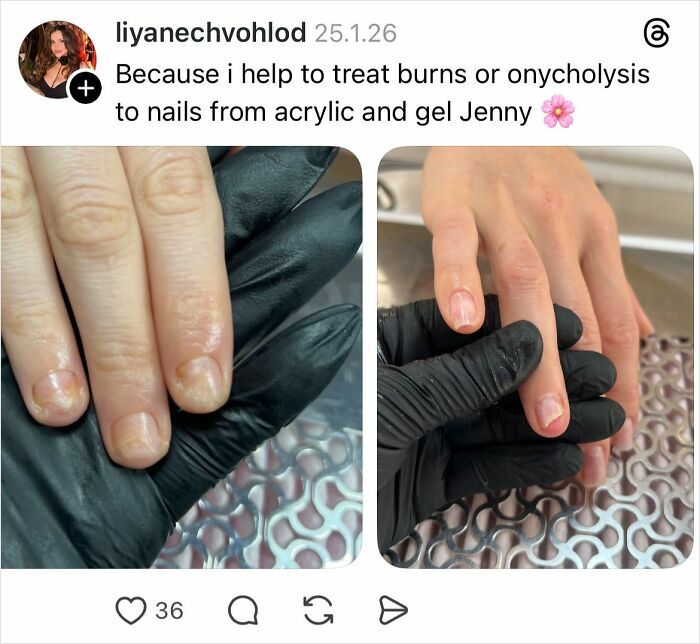 Close-up of hands showing nail damage and treatment by a nail technician wearing black gloves, highlighting nail care and repairs.
