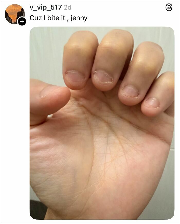 Close-up of a hand with bitten nails, illustrating a savage reply about why girls don’t get their nails done.