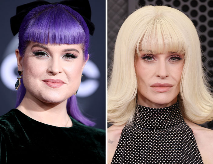 &ldquo;How Is This Possible?&rdquo;: Frenzy Over Botched Plastic Surgery And Weight Loss After The Grammys