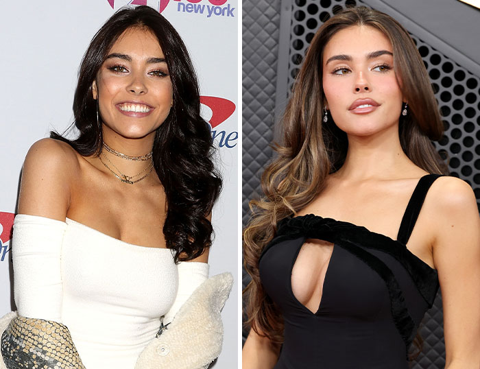 “How Is This Possible?”: Frenzy Over Botched Plastic Surgery And Weight Loss After The Grammys “How Is This Possible?”: Frenzy Over Botched Plastic Surgery And Weight Loss After The Grammys