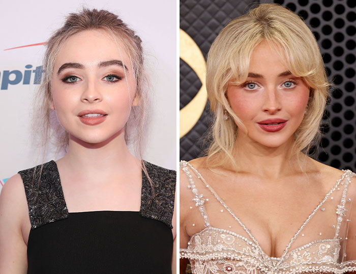 “How Is This Possible?”: Frenzy Over Botched Plastic Surgery And Weight Loss After The Grammys “How Is This Possible?”: Frenzy Over Botched Plastic Surgery And Weight Loss After The Grammys