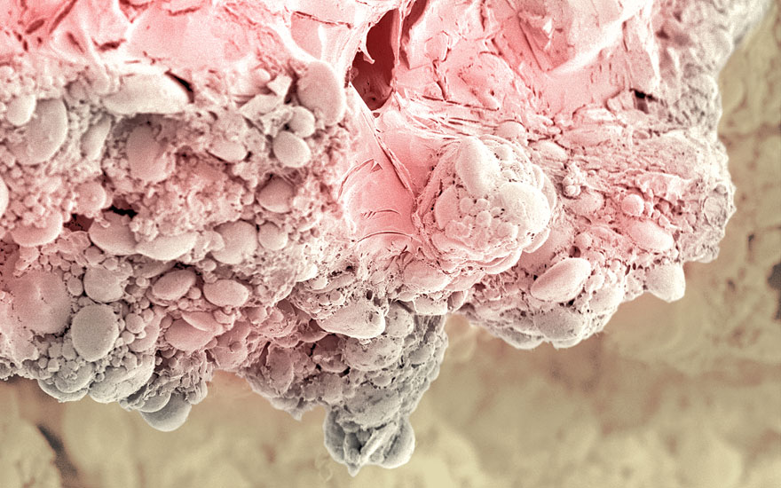 Food Photographed With An Electron Microscope by Caren Alpert