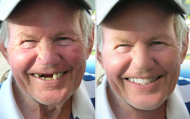 Tool Reveals How Much Celebs & Models Are Photoshopped Tool Reveals How Much Celebs & Models Are Photoshopped