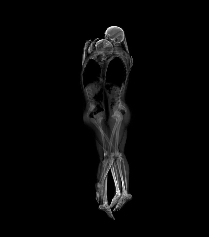 Intimate X-Ray Portraits of Couples by Ayako Kanda and Mayuka Hayashi